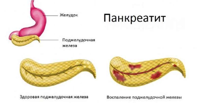 Рецепты при панкреатите поджелудочной железы рецепты с фото простые